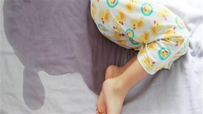 التبول اللا إرادى عند الأطفال 