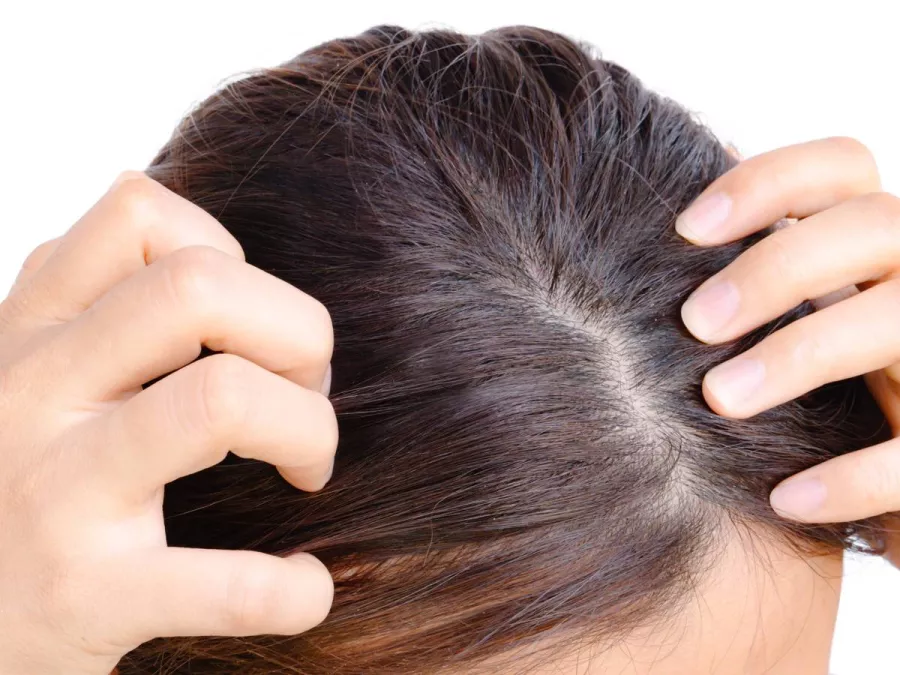 مخاطر تغطية الشعر&nbsp;