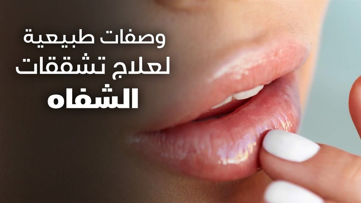 ترطيب الشفاه بالمواد الطبيعية
