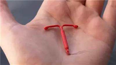 علاقة اللولب بآلام الظهر عند النساء 