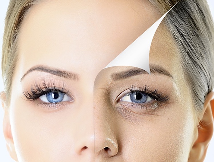 وصفات للهالات السوداء