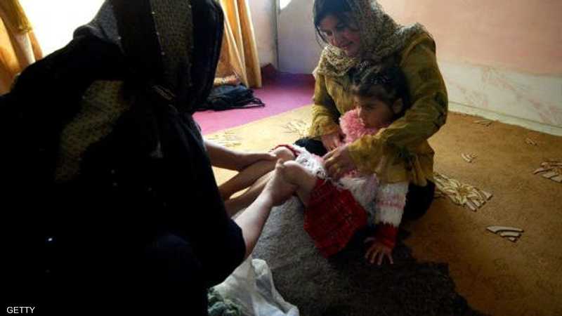 مخاطر ختان الإناث