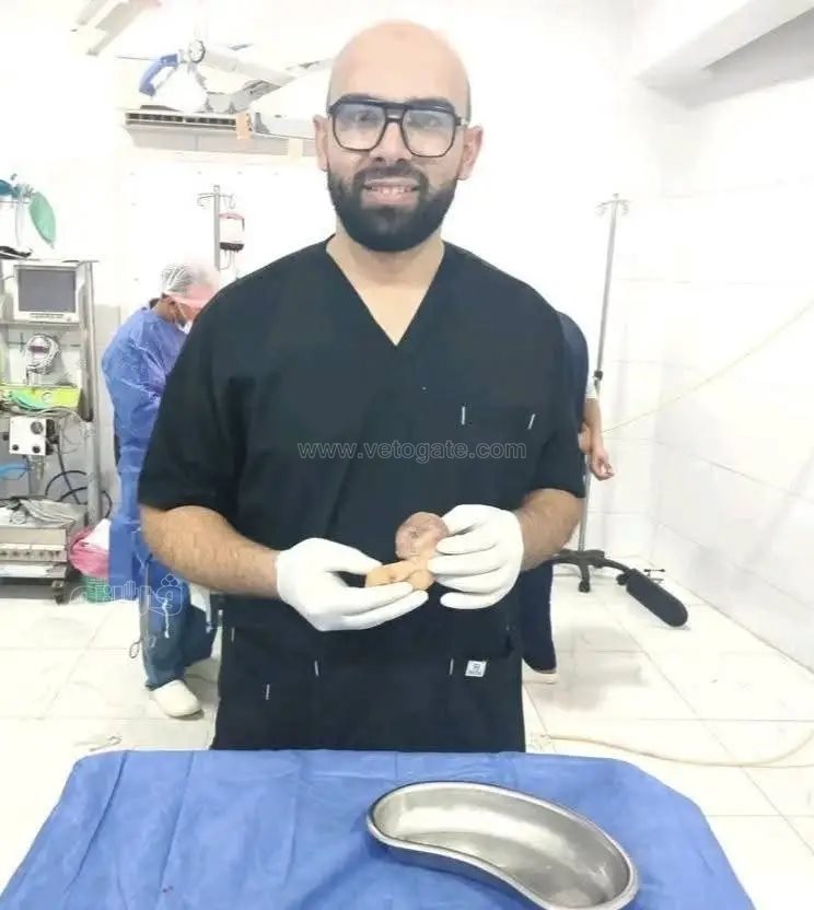 حين نما التوأم في صدر شقيقه… وسُطرت واحدة من أجمل قصص الطب والرحمة،فيتو