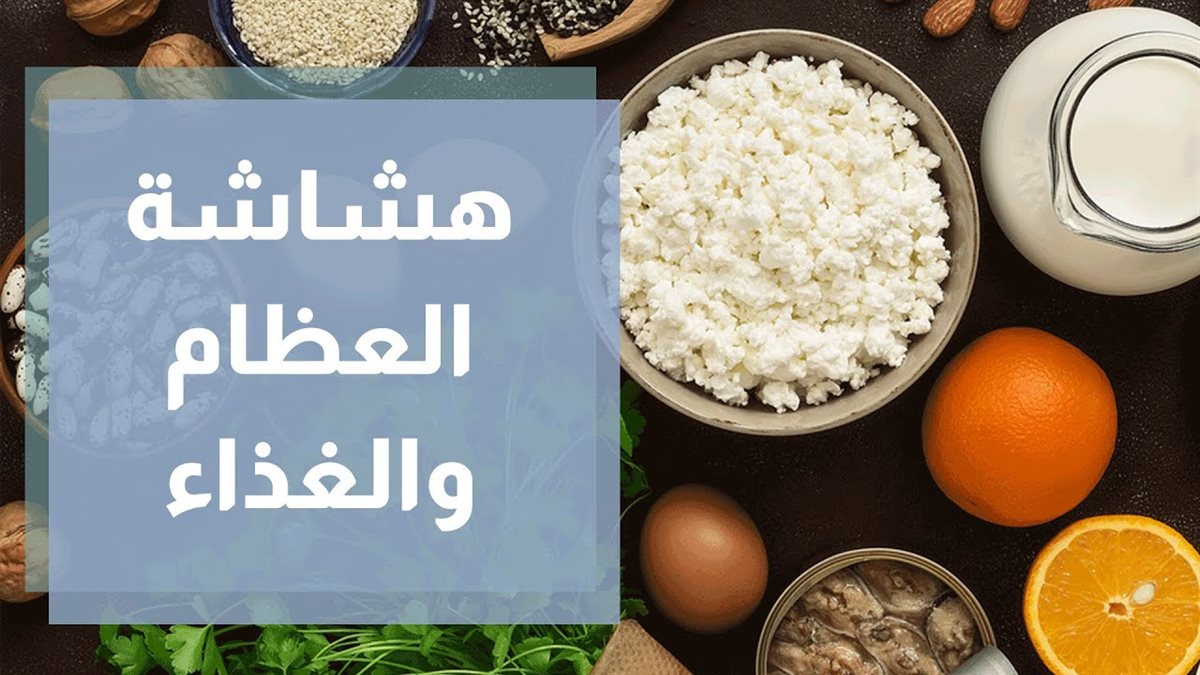 أطعمة تحمي من هشاشة العظام