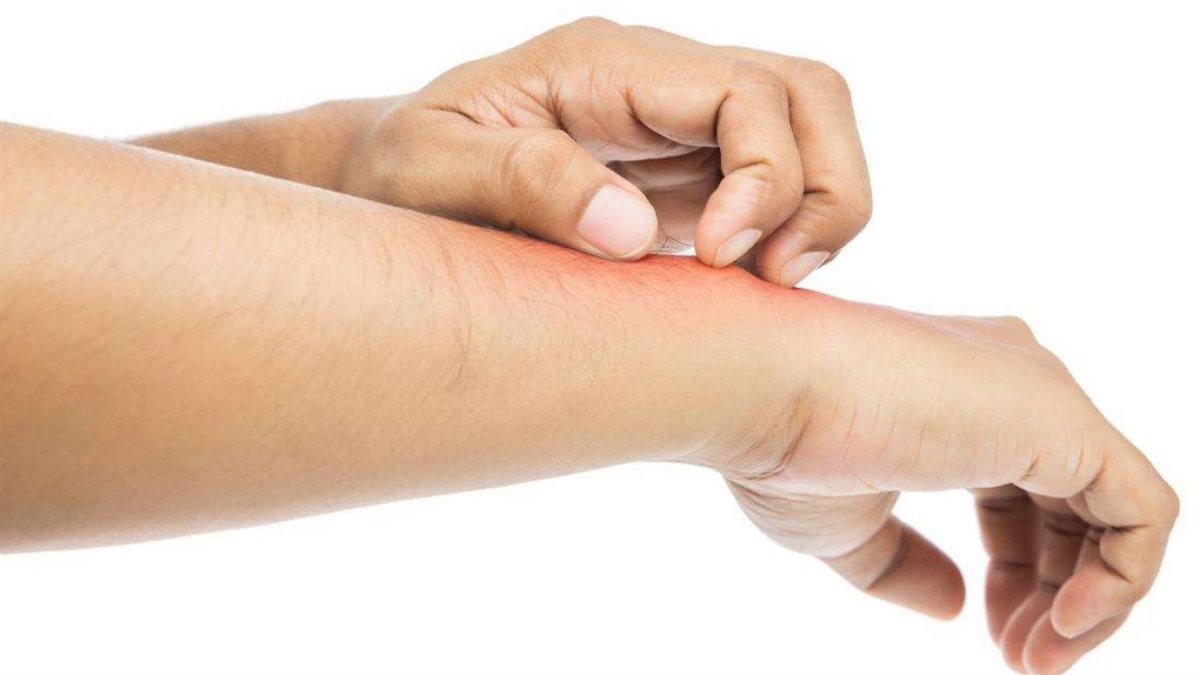 علاج التهابات الجلد