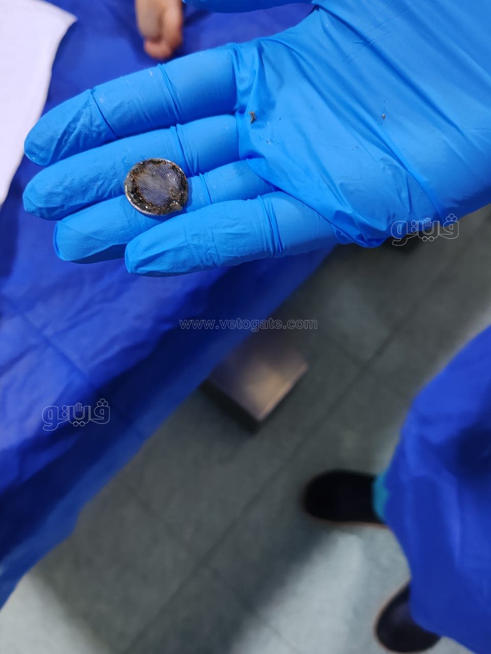 سباق مع الزمن داخل مستشفى أبو كبير.. إنقاذ طفل ابتلع بطارية قبل دقائق من الكارثة،فيتو