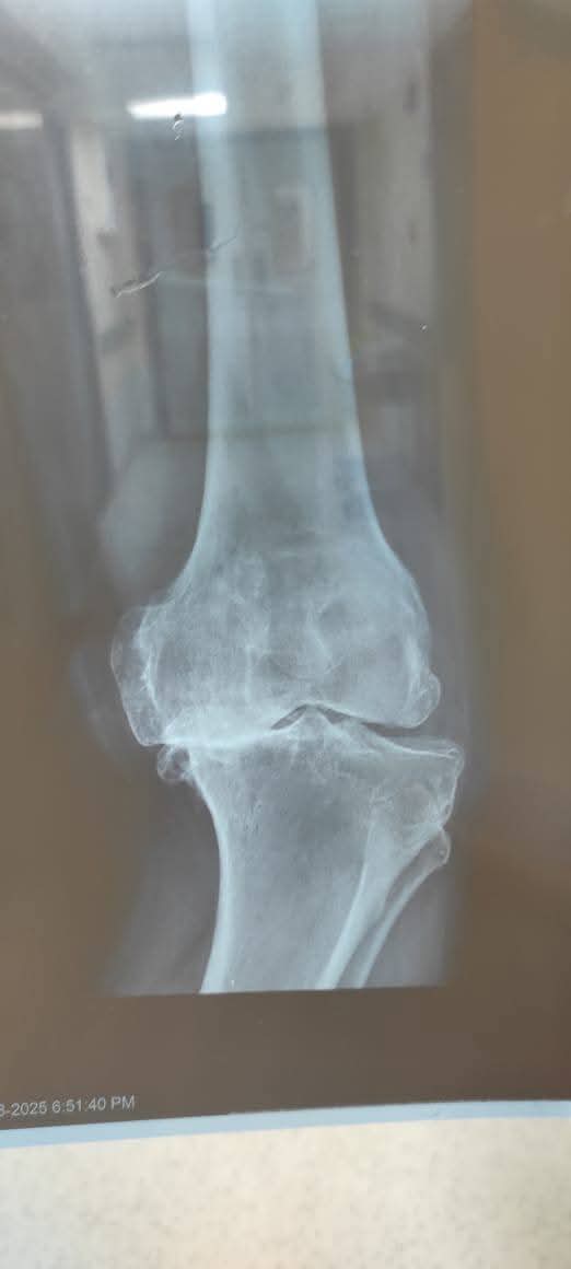 جانب من العملية، فيتو