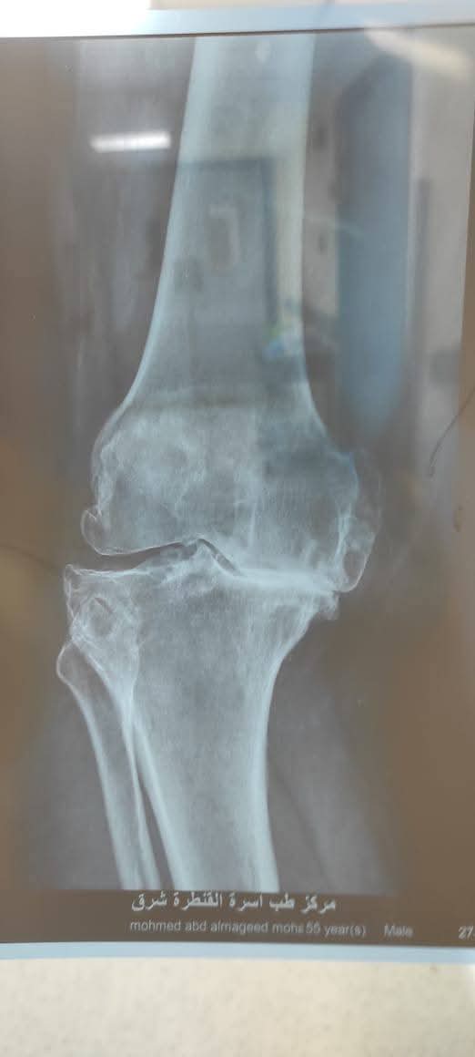 جانب من العملية، فيتو