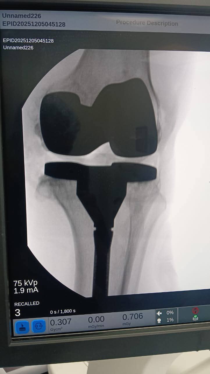 جانب من العملية، فيتو