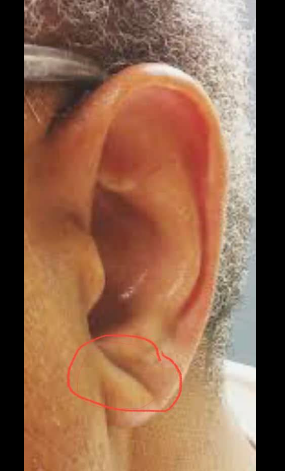 علامة فرانك تشير للخطر، فيتو