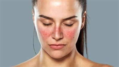 أهمية التغذية السليمة لأصحاب الأمراض المناعية&nbsp;