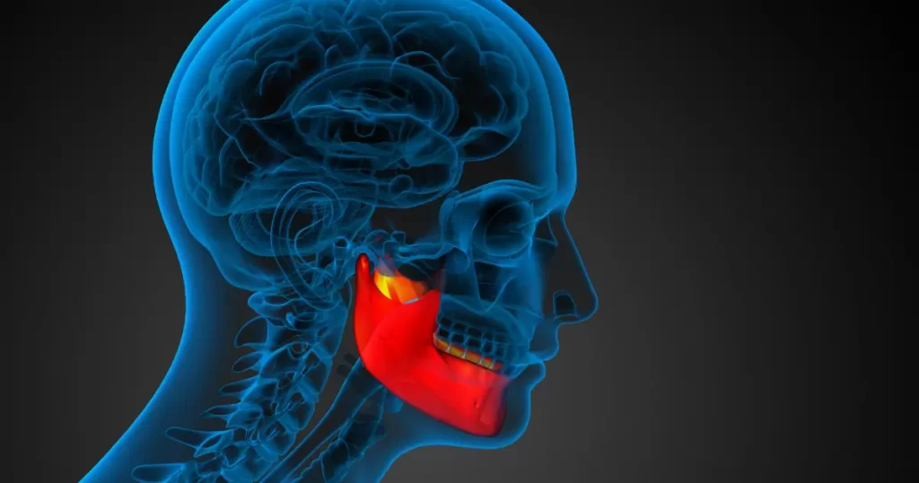 أعراض وأسباب تآكل مفصل الفك&nbsp;
