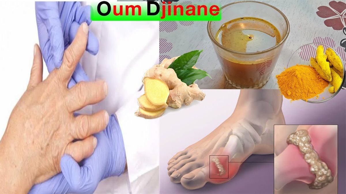 علاج آلام المفاصل بالأعشاب