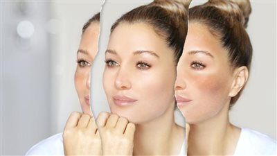 نصائح مهمة تؤخر ظهور التجاعيد بالبشرة