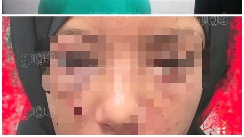 المجني عليها،فيتو