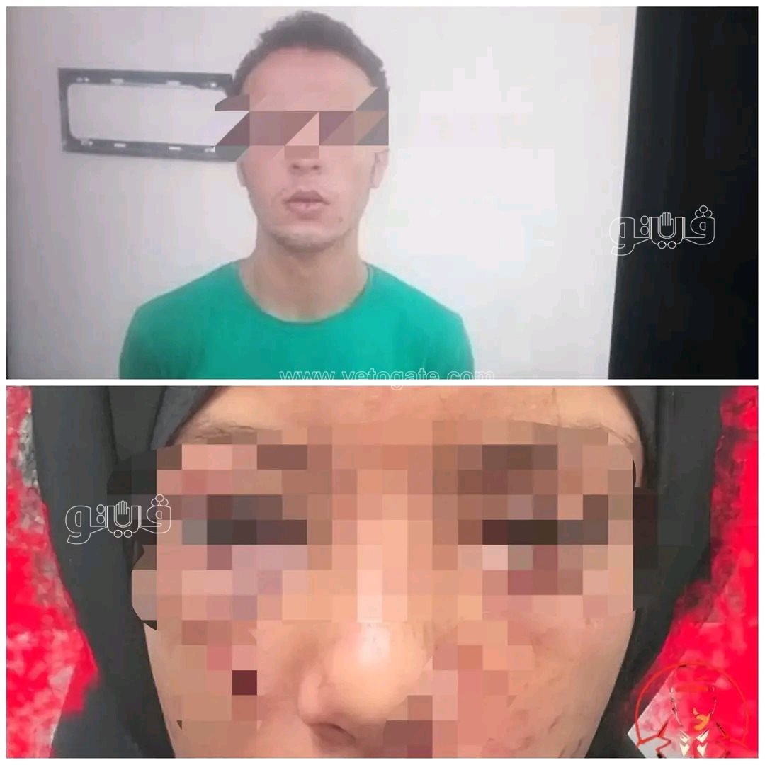 المتهم والمجني عليها،فيتو