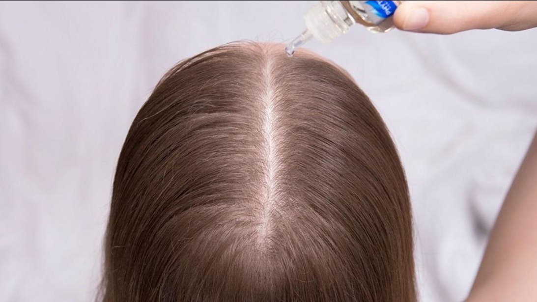 تغذية فروة الرأس