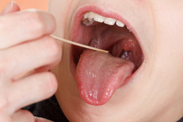علاقة التهاب اللوز بالقلب&nbsp;