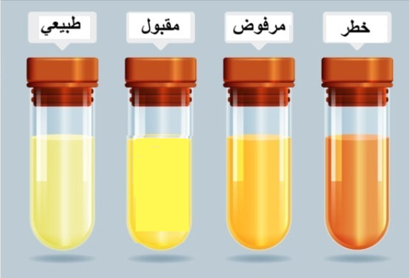 مؤشر شح السوائل من خلال البول، فيتو