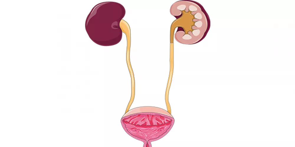 أعراض كسل الكلى وأسبابه وطرق العلاج