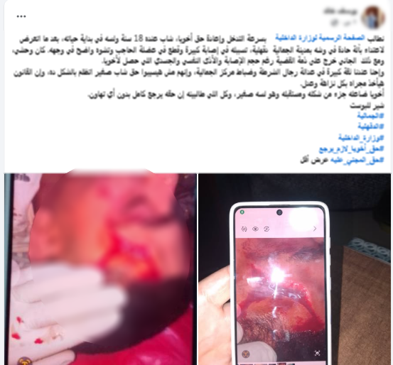 ضبط عامل بالدقهلية لاتهامه بالتعدي على شقيقين وإصابة أحدهما بقطعة زجاج، فيتو
