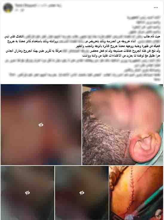 الأمن يكشف ملابسات اعتداء طالب على زميله بسلاح أبيض في البحيرة ويضبط المتهم، فيتو