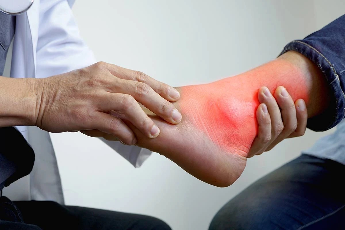 أكلات ممنوعة على مرضى ارتفاع الأملاح بالجسم