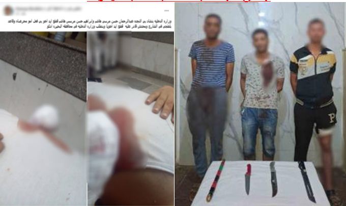 خلاف على تقسيم الميراث يتسبب فى 4 مصابين وبتر فى كف يد أحدهم بالبحيرة&nbsp;