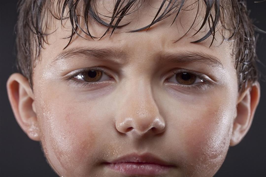 أسباب تعرق الأطفال الغزير من الرأس
