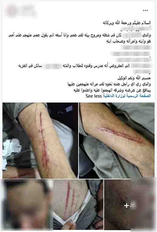 الأمن يكشف ملابسات الاعتداء على عامل بسبب خلافات الميراث في الشرقية ورغبتهم في طرده من المنزل، فيتو