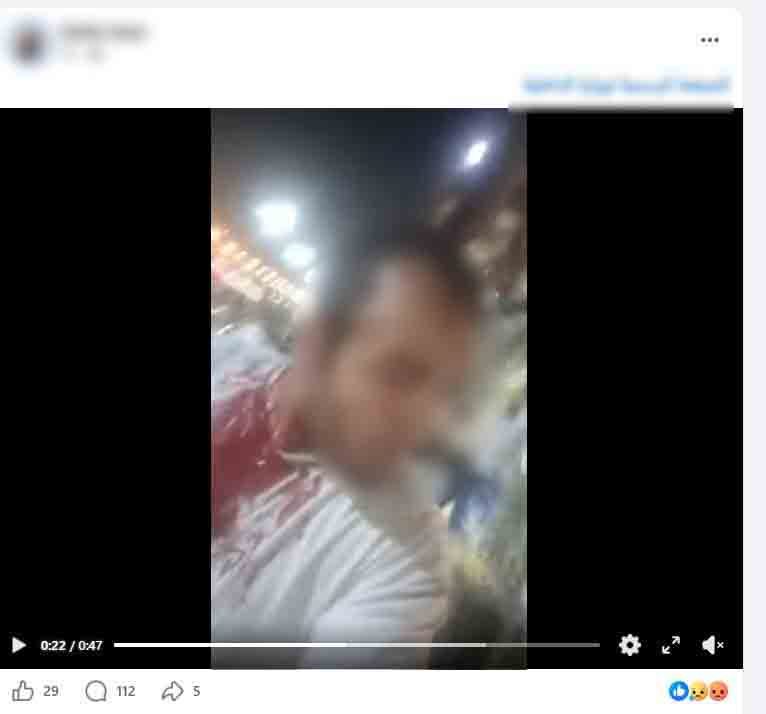 خلاف على بيع كلب يشعل مشاجرة ساخنة وتتسبب فى إصابة تاجر بحدائق القبة&nbsp;
