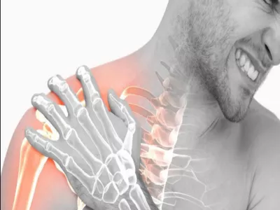 أسباب وأعراض الكتف المتجمد