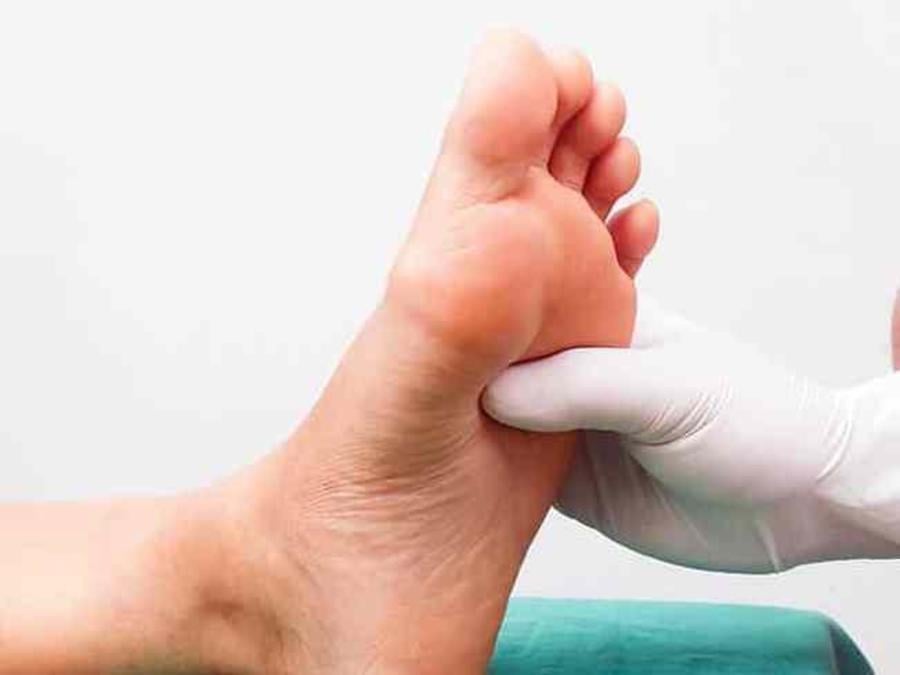 7 أسباب وراء الإصابة بتنميل أصابع القدم&nbsp;