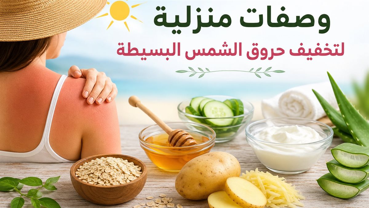 وصفات لعلاج حروق الشمس