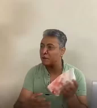 والد الطفلة