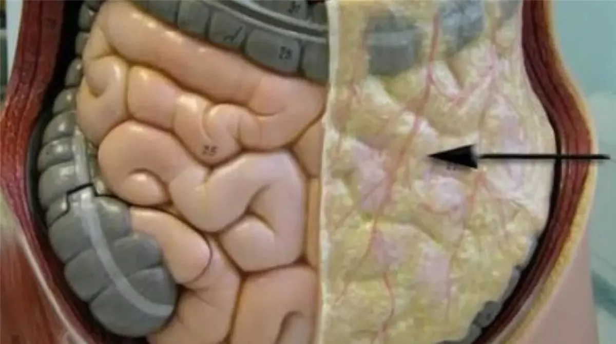 أسباب خطورة الدهون الحشوية أكثر من الدهون تحت الجلد؟