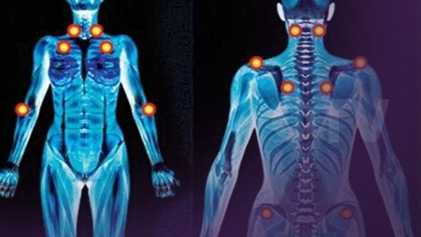 10 نصائح تساعد فى علاج الفايبروميالجيا