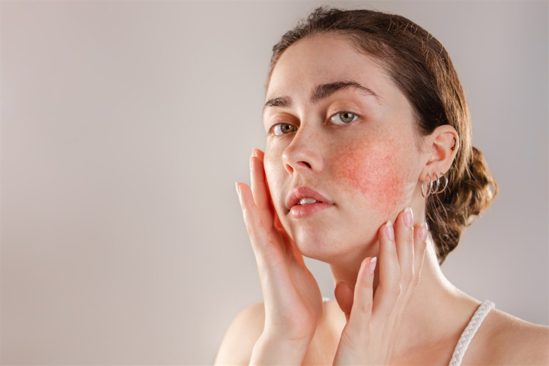 ترطيب البشرة الحساسة