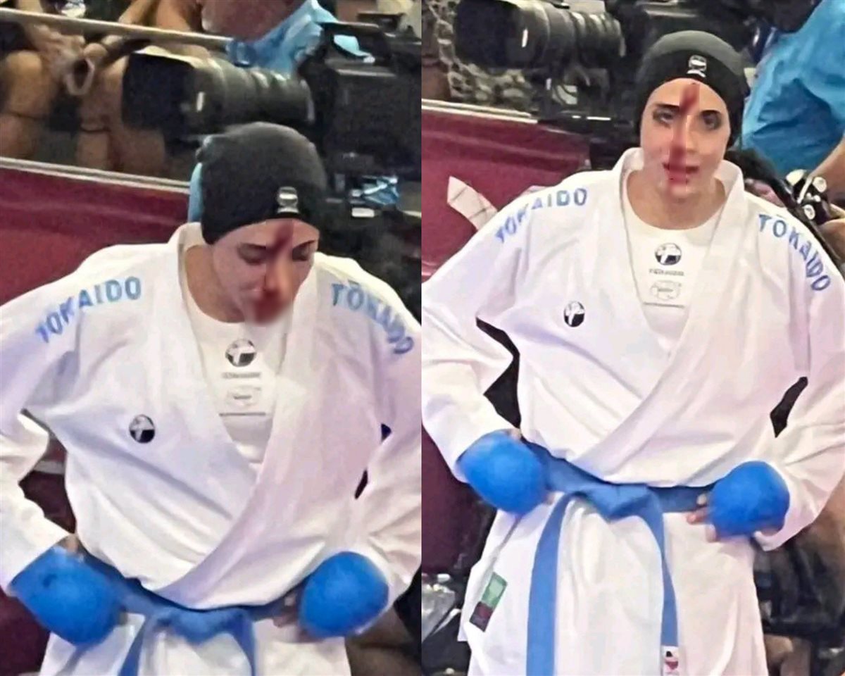 إصابة فريال أشرف، فيتو