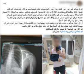 رصاصة طائشة تصيب شخصًا أثناء مروره بالصدفة بجوار مشاجرة في الإسماعيلية، وضبط المتهم، فيتو