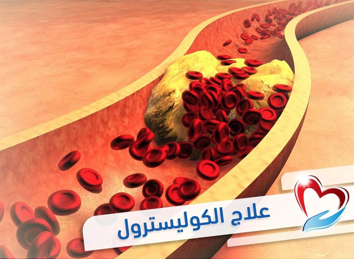 علاج الكوليسترول العالي