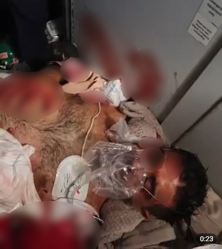 مشاهد لإصابات خطيرة لقائد طائرة فلاي دبي ومساعده بعد محاولة إسقاطها وعلى متنها 150 إسرائيليًا
