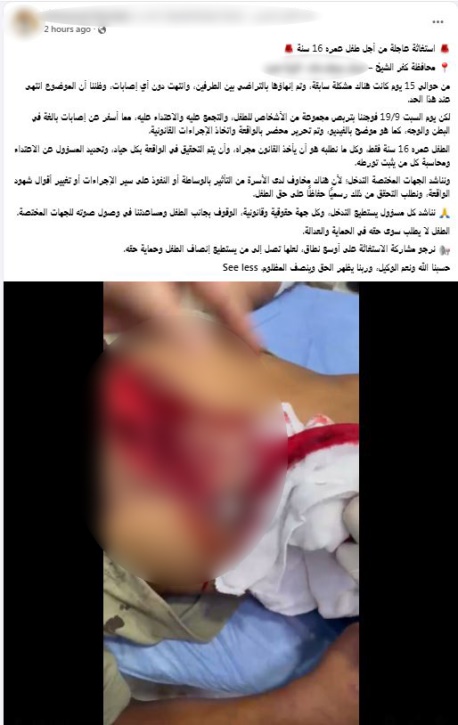 خلافات الجيرة تتحول إلى الاعتداء على طفلين بكفر الشيخ، وضبط المتهم