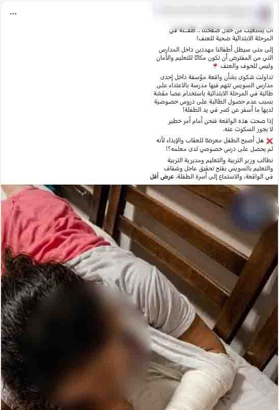 مدرسة بالسويس تعتدى على طالبة بعصا خشبية وأصابتها بشرخ في اليد تنتهى بضبطها