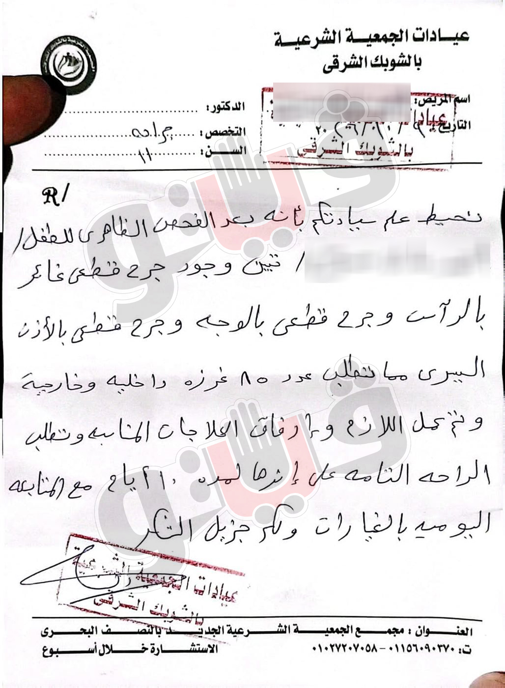 85 غرزة في وجه ورأس تلميذ، مشادة بين طفلين على باب مدرسة تنتهي بمأساة (صور ومستندات)