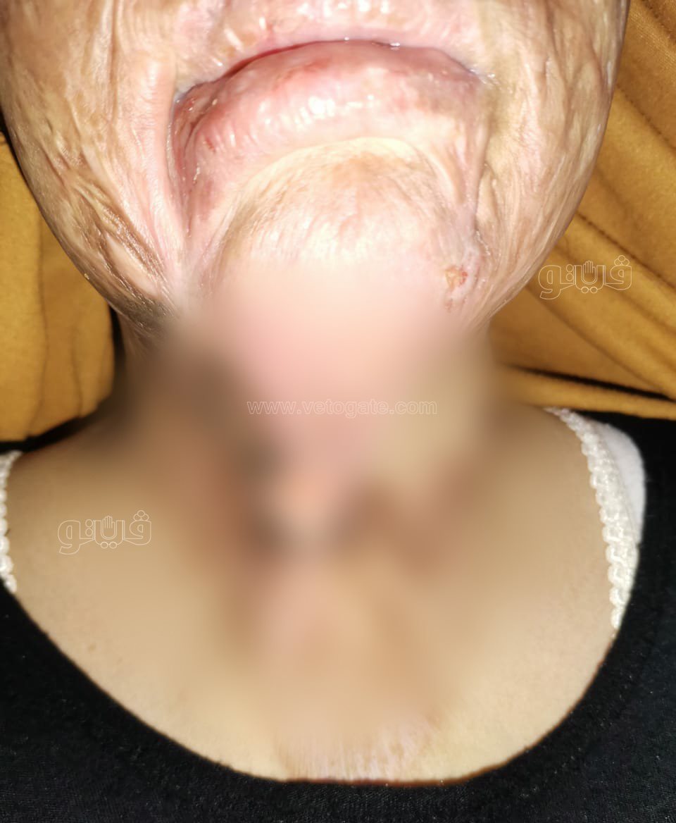 سيدة اصيبت بالحروق (2)