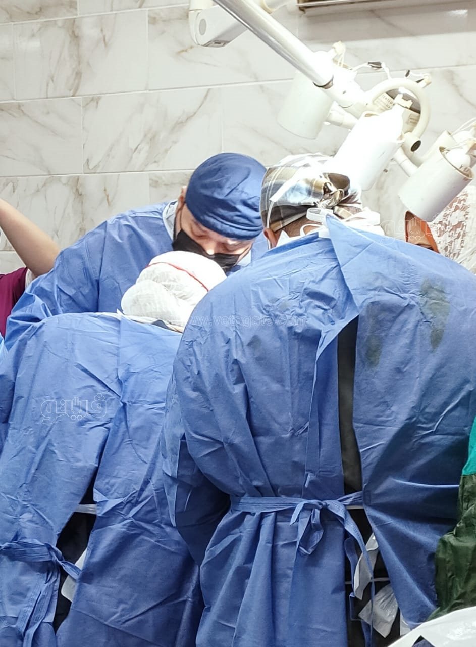 سيدة تضع 5 توائم في ولادة قيصرية (2)