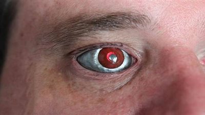 كندي يحول عينيه إلى كاميرا للتصوير/ فيديو 