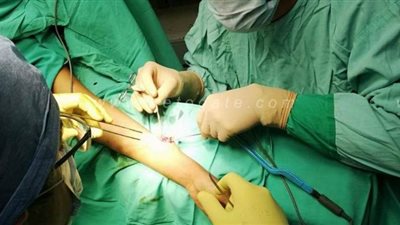 صحة البحر الأحمر: إجراء 35 عملية استئصال أورام وأوعية دموية خلال أسبوع | صور