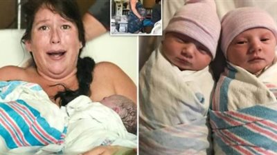 سيدة ذهبت لولادة طفلة.. فتفاجأت بتوأم| صور